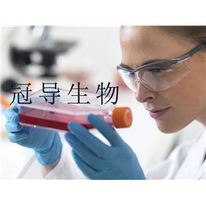 KU-19-19 Cells人膀胱癌細(xì)胞系(提供STR圖譜),KU-19-19 Cells