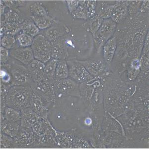 WM-266-4 Cells人黑素瘤細胞系(提供STR圖譜)