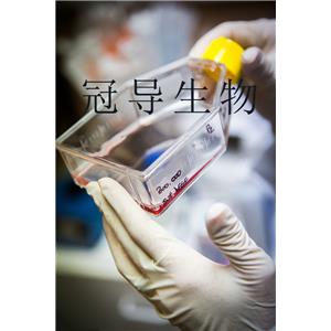 UM-Chor1 Cells人系膜細(xì)胞系,UM-Chor1 Cells