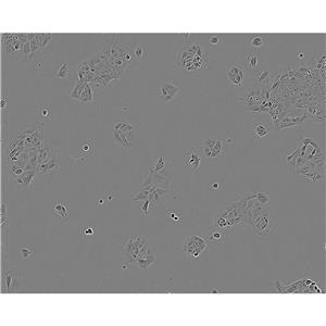 GCT Cells人巨细胞瘤细胞系(提供STR图谱)