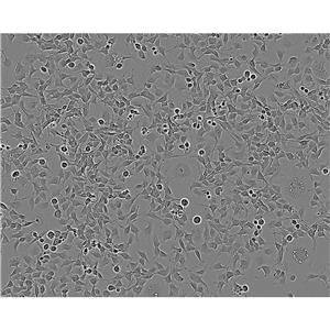 NCI-H187 Cells人小細(xì)胞肺癌細(xì)胞系(提供STR圖譜),NCI-H187 Cells