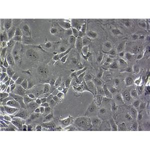 REC-1 Cells人非霍奇金淋巴瘤細胞系,REC-1 Cells