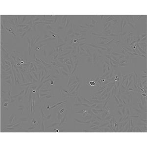 B104 Cells大鼠神經(jīng)母細胞瘤細胞系,B104 Cells