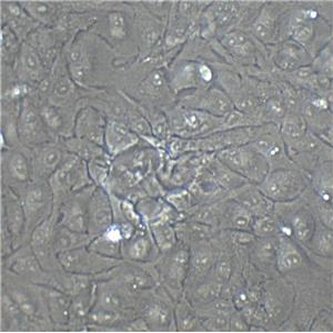 Hepa 1-6 Cells小鼠肝癌細(xì)胞系,Hepa 1-6 Cells