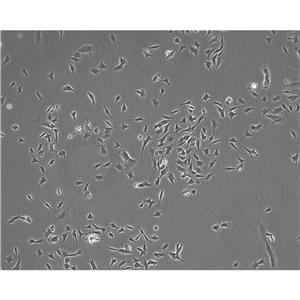 Y1[Y-1] Cells小鼠腎上腺皮質(zhì)瘤細胞系(提供STR圖譜)