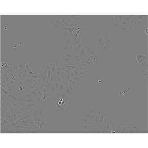 CHO/dhFr-[CHO-DXB11] Cells仓鼠卵巢细胞系<二氢叶酸还原酶缺陷>(提供STR图谱)