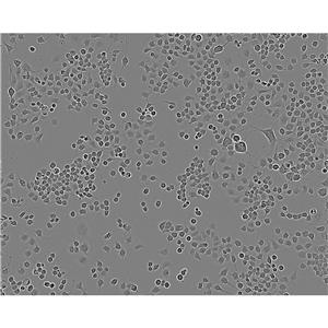 MHCC97-L Cells低轉(zhuǎn)移人肝癌細(xì)胞系(提供STR圖譜)