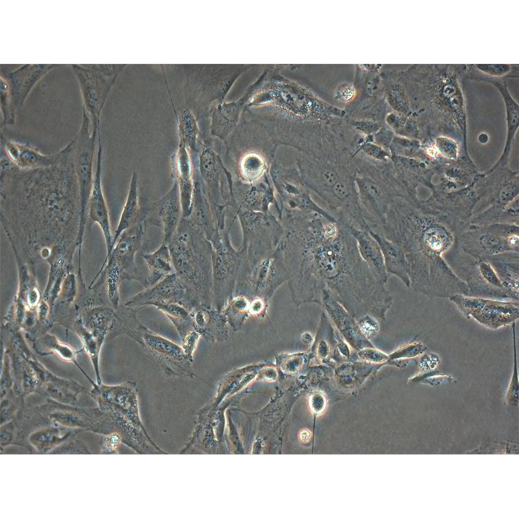 NCI-N87 Cells人胃癌細(xì)胞系,NCI-N87 Cells