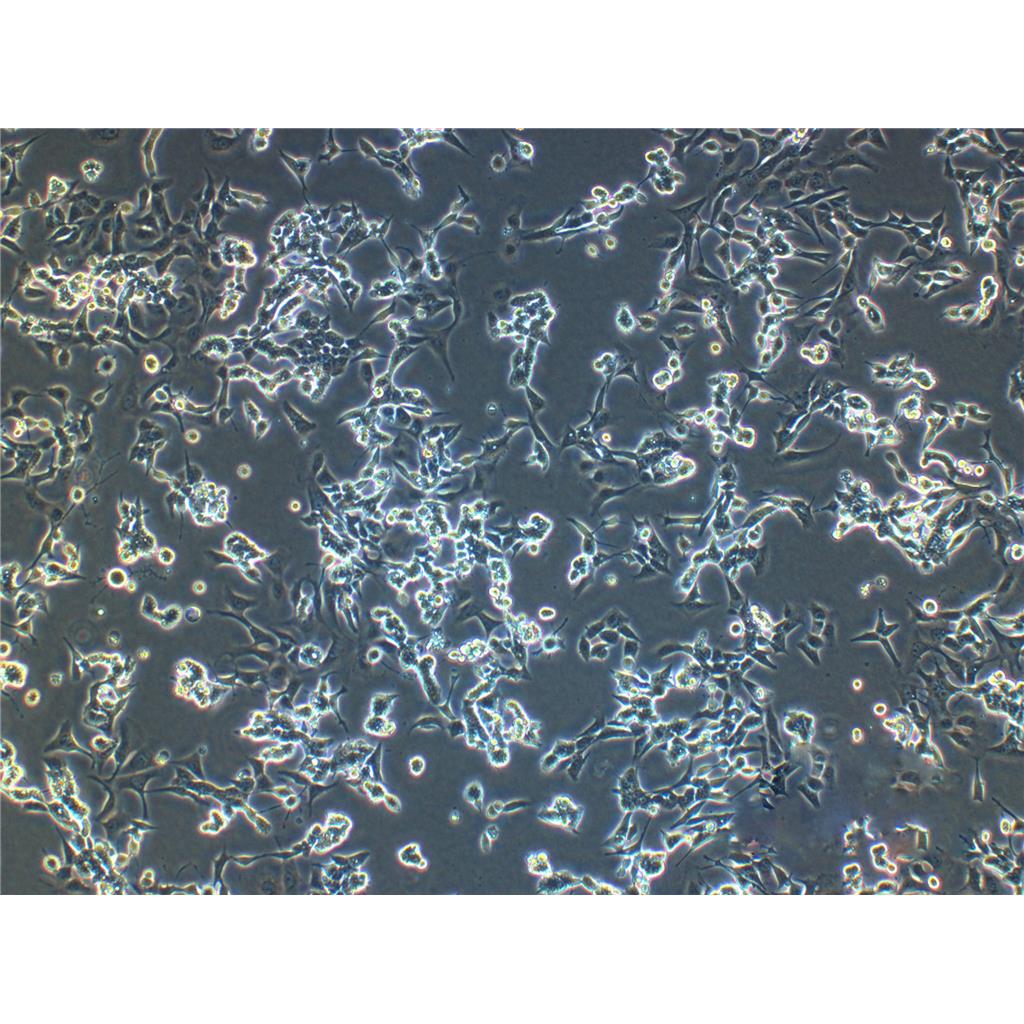 L5178Y TK+/- (clone 3.7.2C) Cells小鼠淋巴瘤細(xì)胞系,L5178Y TK+/- (clone 3.7.2C) Cells