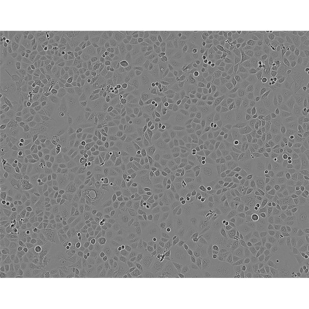 mda-MB-175-VII Cells人乳腺導(dǎo)管癌細(xì)胞系,mda-MB-175-VII Cells