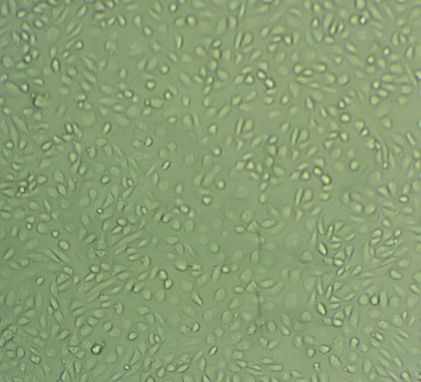 KATO III Cells人胃癌細(xì)胞系(提供STR圖譜),KATO III Cells