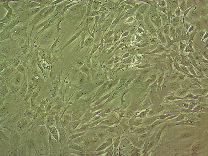 hFOB 1.19 Cells人SV40轉染成骨細胞系,hFOB 1.19 Cells