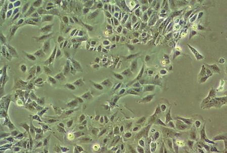 SW1353 Cells人軟骨肉瘤細胞系(提供STR圖譜),SW1353 Cells