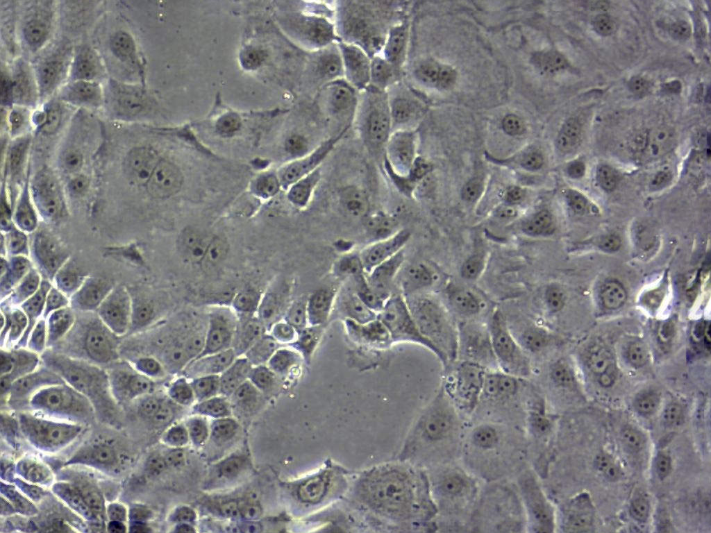 SW13 Cells人腎上腺皮質(zhì)瘤細胞系,SW13 Cells