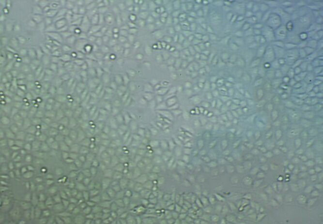 SW-579 Cells人甲狀腺鱗癌細(xì)胞系,SW-579 Cells