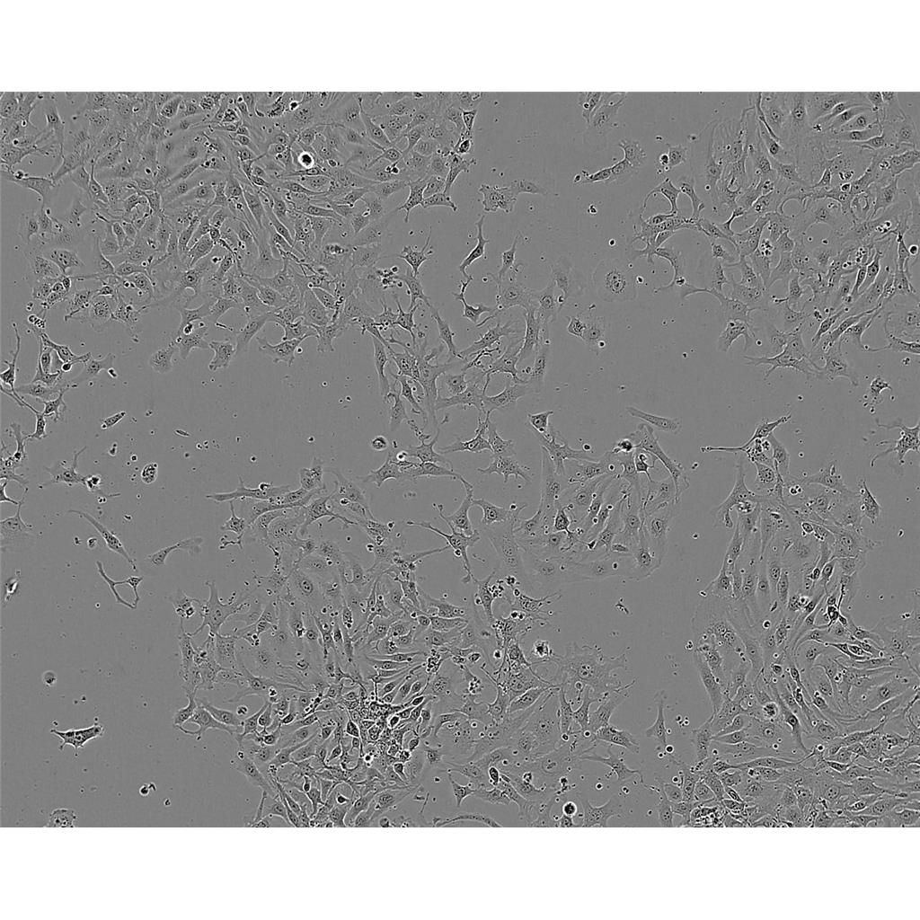 CA-46 Cells人burkitt淋巴瘤細胞系,CA-46 Cells