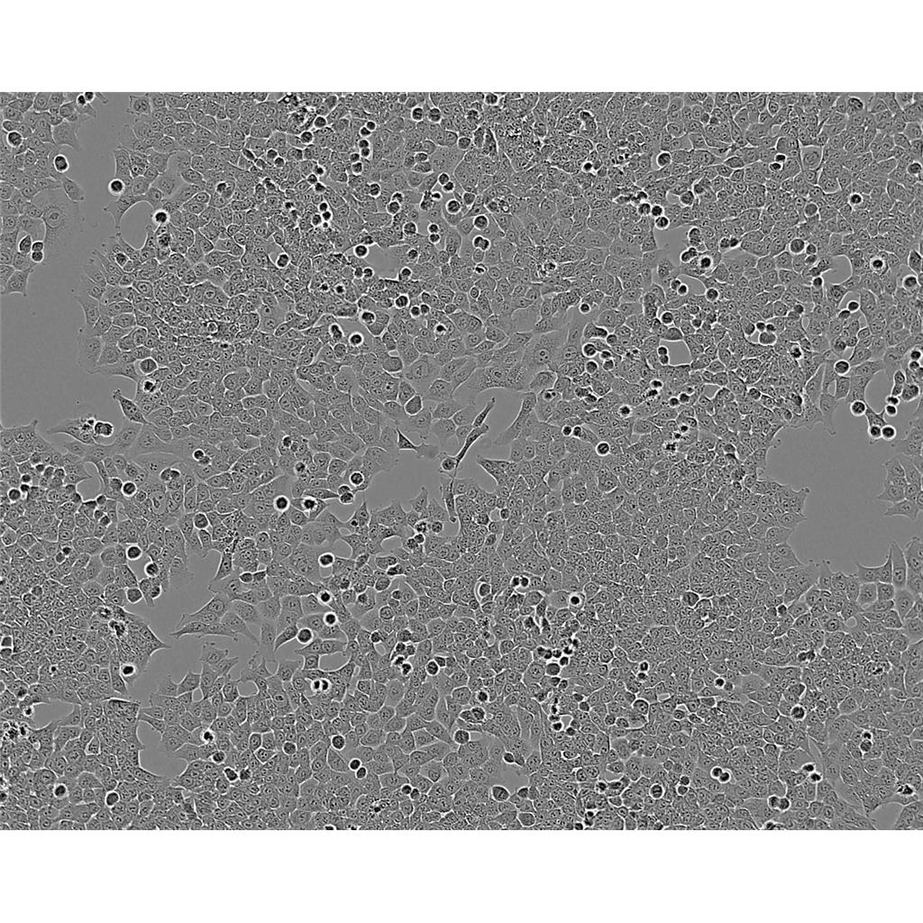 SK N SH Cells人神經(jīng)母細胞瘤細胞系,SK N SH Cells