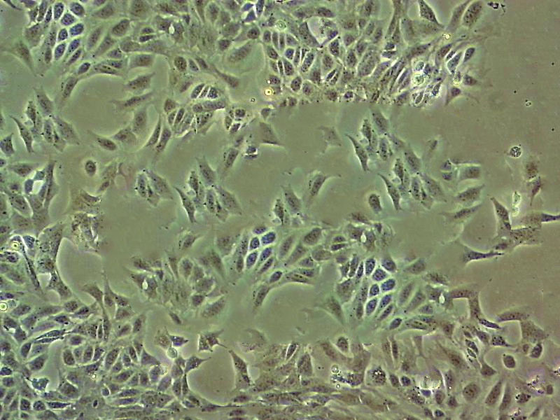 A431 Cells人皮膚鱗癌細胞系,A431 Cells