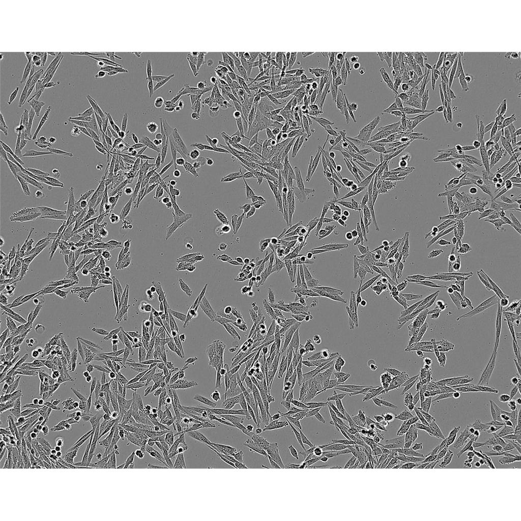 mda-MB 453 Cells人乳腺癌細胞系,mda-MB 453 Cells