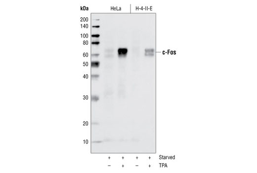 c-Fos（9F6）兔單克隆抗體,c-Fos (9F6) Rabbit mAb