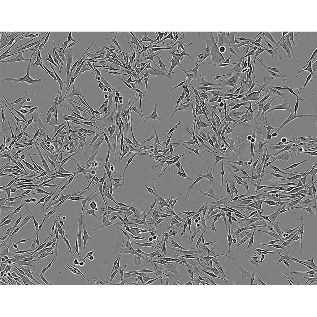 4T1-A Cells小鼠乳腺癌細(xì)胞系,4T1-A Cells