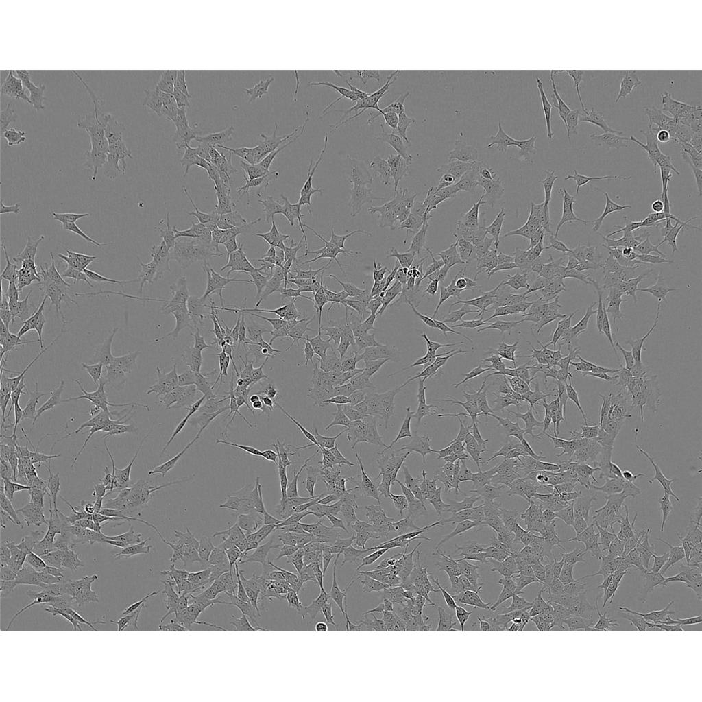 SJSA1 Cells人骨肉瘤細(xì)胞系,SJSA1 Cells