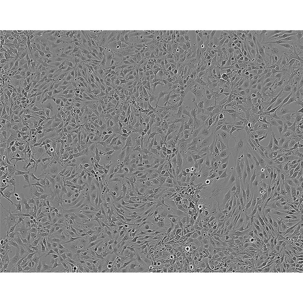 mda MB 436 Cells人乳腺癌細(xì)胞系,mda MB 436 Cells