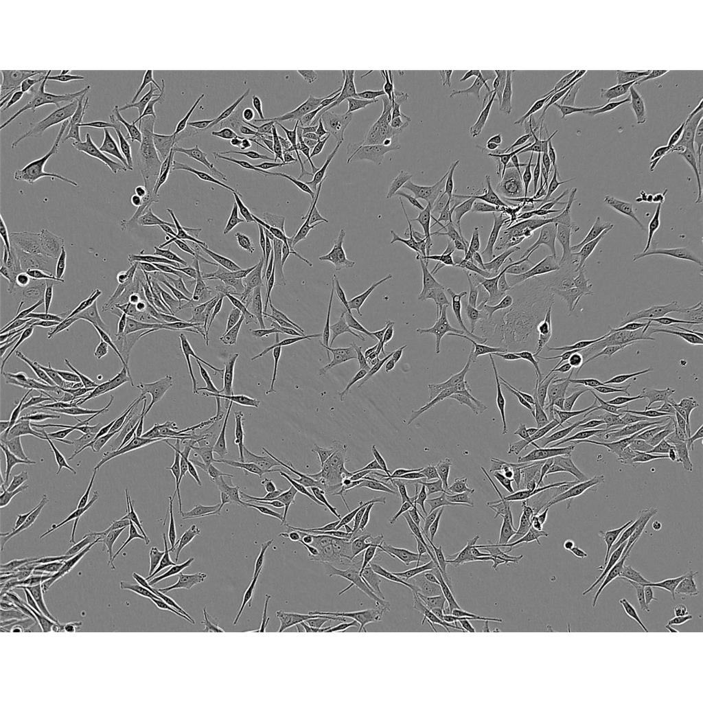 mda MB 175 VII Cells人乳腺導(dǎo)管癌細(xì)胞系,mda MB 175 VII Cells