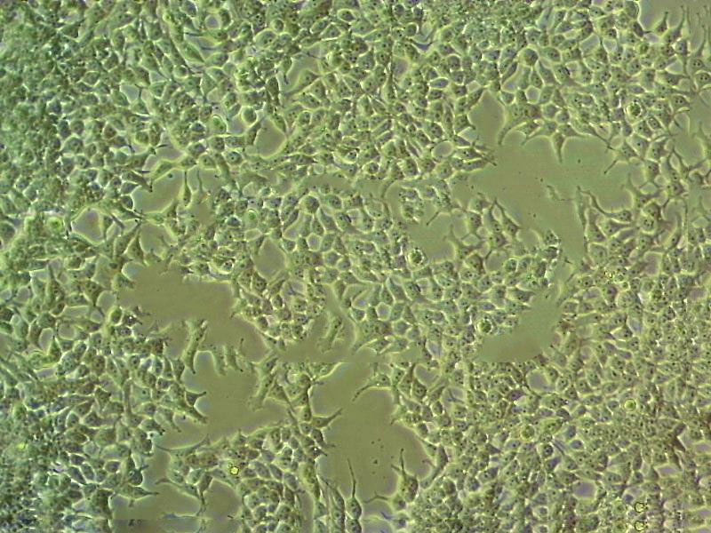 A673 Cells人橫紋肌肉瘤細胞系,A673 Cells