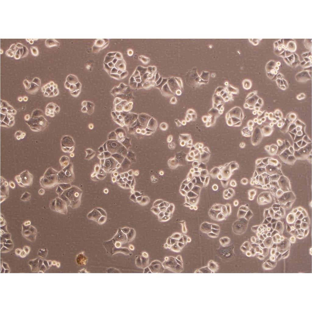 COLO-320DM Cells人結(jié)直腸腺癌細(xì)胞系,COLO-320DM Cells