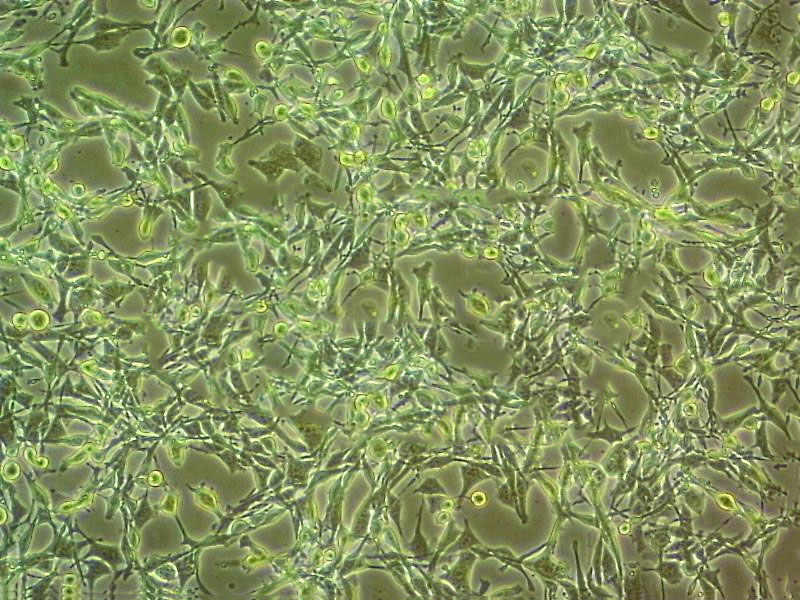 HUV-EC-C Cells人臍靜脈血管內(nèi)皮細(xì)胞系,HUV-EC-C Cells