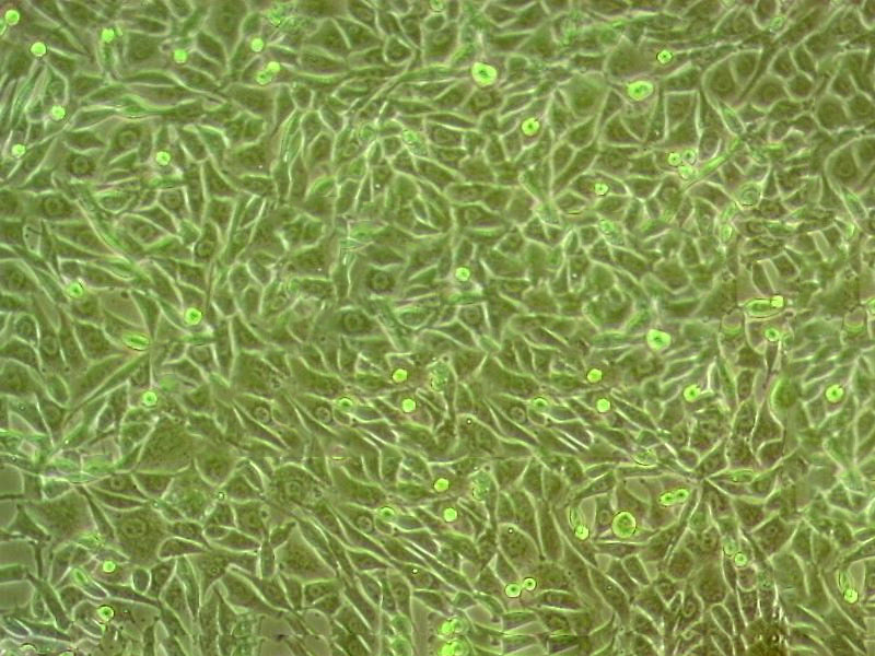 RPMI 2650 Cells人鼻腔上皮細胞系,RPMI 2650 Cells