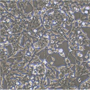 CCRF-CEM Cells人急性淋巴细胞白血病T淋巴细胞系(提供STR图谱)