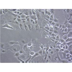 MCF-10A Cells人正常乳腺上皮细胞系(提供STR图谱)