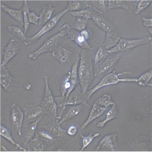 HCT 8 Cells人結(jié)直腸腺癌細胞系(提供STR圖譜)