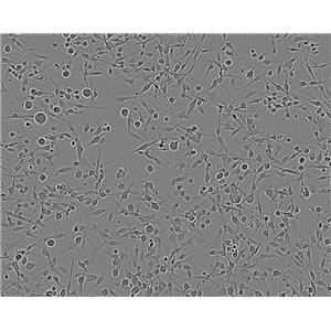 HSF Cells人皮肤成纤维细胞系(提供STR图谱)