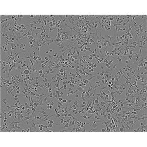 SW-620 Cells人結(jié)腸癌細胞系,SW-620 Cells