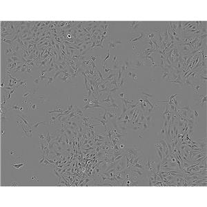 CA-46 Cells人burkitt淋巴瘤細(xì)胞系,CA-46 Cells