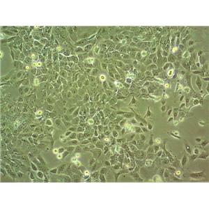 T2 (174 x CEM.T2) Cells人淋巴母細胞系(提供STR圖譜)