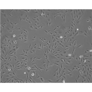 BT 549 Cells人乳腺導(dǎo)管癌細(xì)胞系,BT 549 Cells