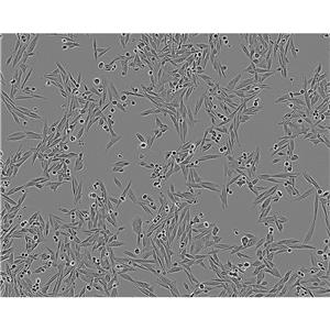 mda-MB 453 Cells人乳腺癌細胞系,mda-MB 453 Cells