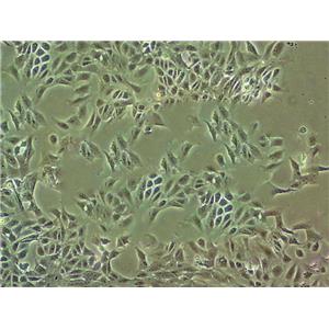 HBL 100 Cells人整合SV40基因的乳腺上皮細(xì)胞系,HBL 100 Cells