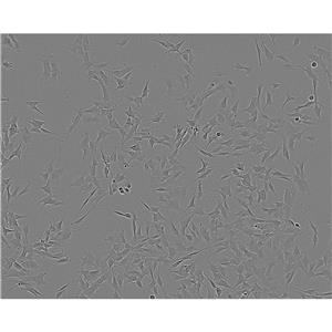 SJSA1 Cells人骨肉瘤細(xì)胞系(提供STR圖譜)