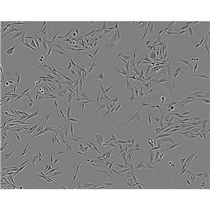 mda MB 175 VII Cells人乳腺導(dǎo)管癌細(xì)胞系,mda MB 175 VII Cells