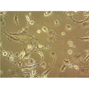 MDBK (NBL-1) Cells牛肾细胞系(提供STR图谱)