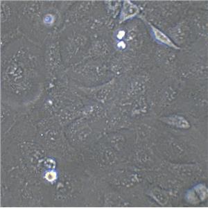 CCD1095Sk Cells人乳腺浸潤(rùn)性導(dǎo)管癌旁皮膚細(xì)胞系,CCD1095Sk Cells