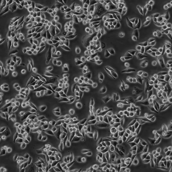 95-D[PLA-801D] Cells人高轉移肺癌復蘇細胞系(有STR鑒定圖譜),95-D[PLA-801D] Cells