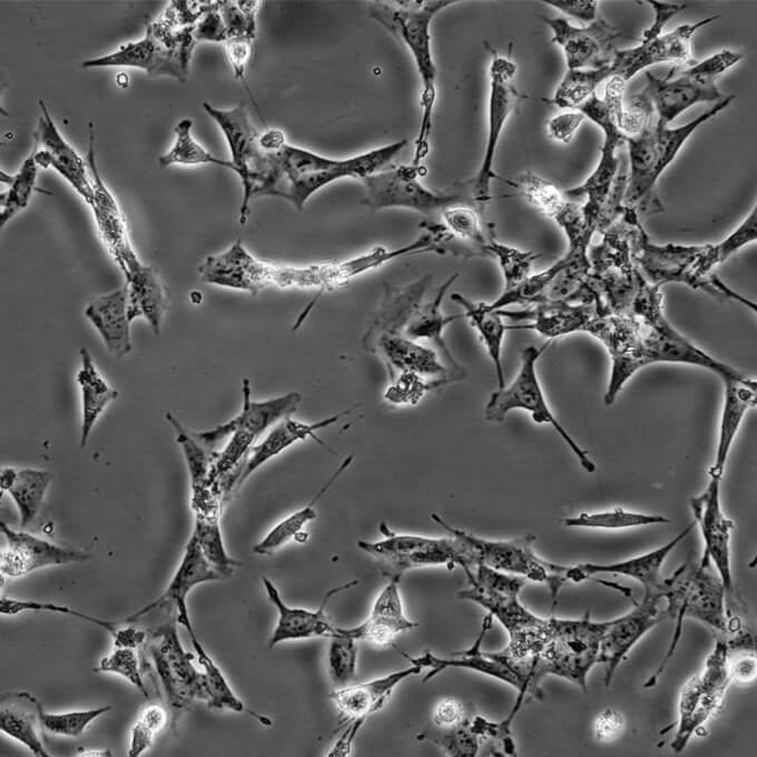 AAV-293 Cells人胚腎復(fù)蘇細(xì)胞系(有STR鑒定圖譜),AAV-293 Cells