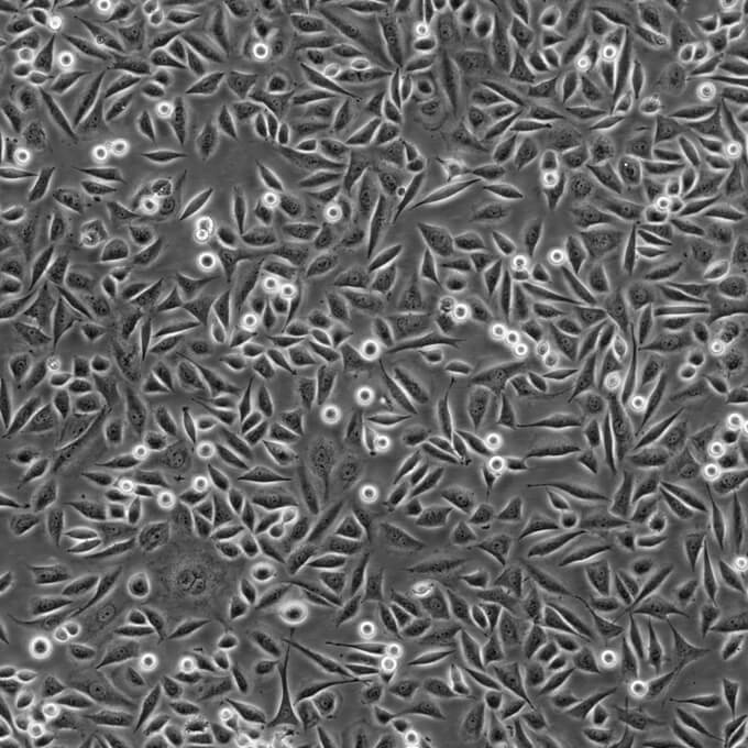 ACHN Cells人腎細(xì)胞腺癌復(fù)蘇細(xì)胞系(有STR鑒定圖譜),ACHN Cells