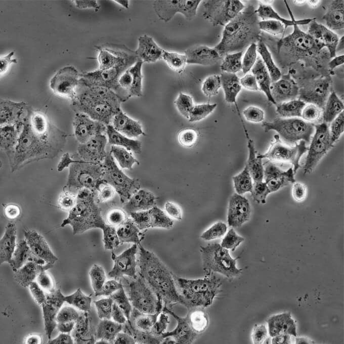 Anglne Cells人卵巢癌復(fù)蘇細(xì)胞系(有STR鑒定圖譜),Anglne Cells